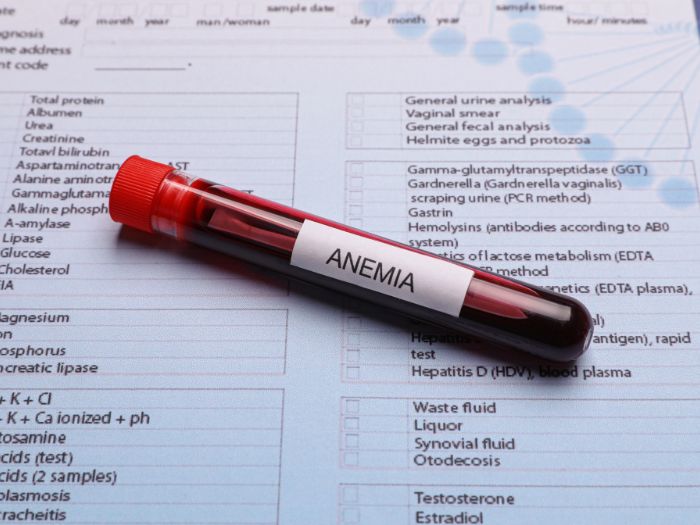 Iron Deficiency Anaemia